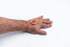 Healing Spacer™ - Wound Healing Kit